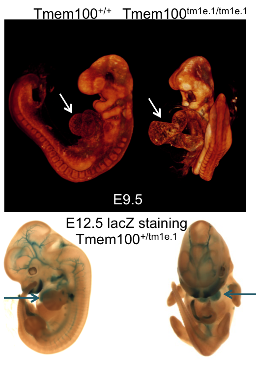 Tmem100 wildtype embryo compared to a mutant